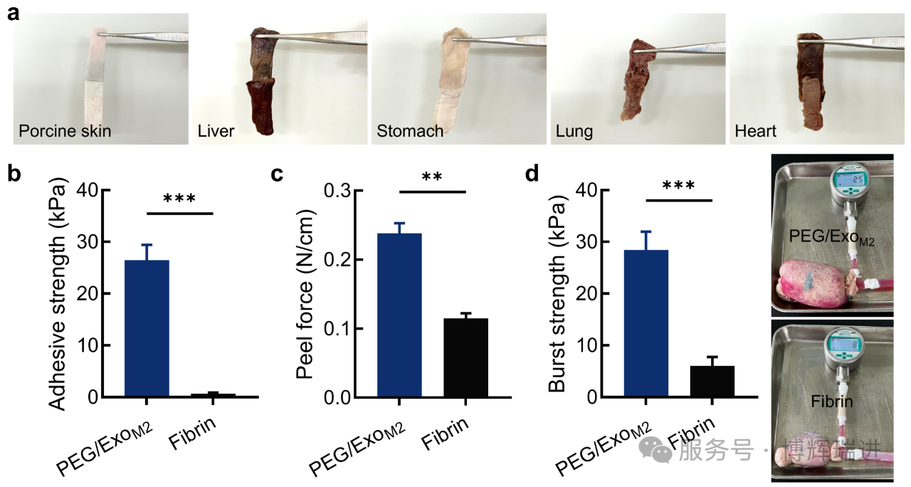 可吸收医用胶（博辉瑞进）